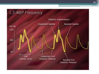 Iabp instrumentation, indications and complications | PPTX