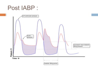 Post IABP :
 