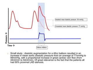  Small study : diastolic augmentation for a 40cc balloon resulted in an
increase in mean aortic diastolic pressure from an average of 77mmHg to
99mmHg, with a proportional increase in great cardiac vein flow (from
44ml/min to 54ml/min). Of great relevance is the fact that the patients all
had 90% proximal LAD stenosis.
 
