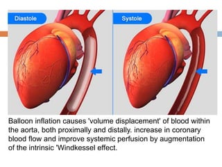 Balloon inflation causes 'volume displacement' of blood within
the aorta, both proximally and distally. increase in coronary
blood flow and improve systemic perfusion by augmentation
of the intrinsic 'Windkessel effect.
 