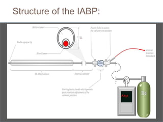 Structure of the IABP:
 