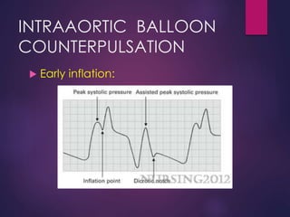 INTRAAORTIC BALLOON
COUNTERPULSATION
 Early inflation:
 