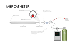 IABP CATHETER
 