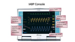IABP Console
 