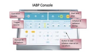 IABP Console
 