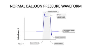 NORMAL BALLOON PRESSURE WAVEFORM
 