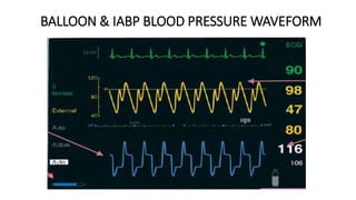 BALLOON & IABP BLOOD PRESSURE WAVEFORM
 