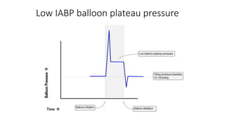 Low IABP balloon plateau pressure
 