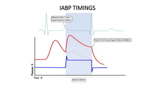 IABP TIMINGS
 