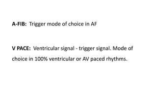 A-FIB: Trigger mode of choice in AF
V PACE: Ventricular signal - trigger signal. Mode of
choice in 100% ventricular or AV paced rhythms.
 