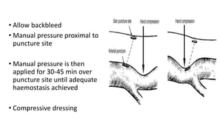 • Allow backbleed
• Manual pressure proximal to
puncture site
• Manual pressure is then
applied for 30-45 min over
puncture site until adequate
haemostasis achieved
• Compressive dressing
 