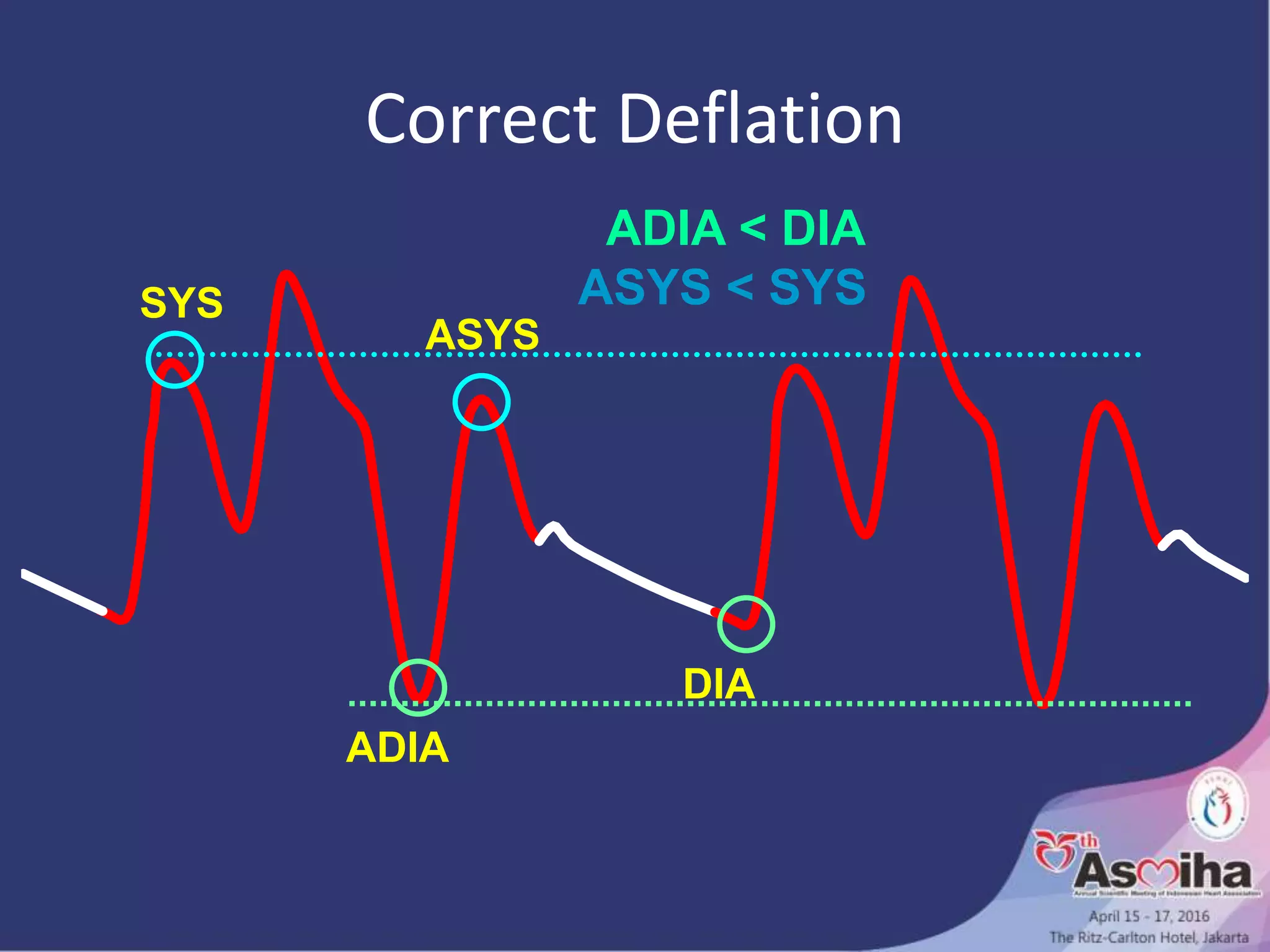 Correct Deflation
ADIA < DIA
ASYS < SYSSYS
ASYS
ADIA
DIA
 