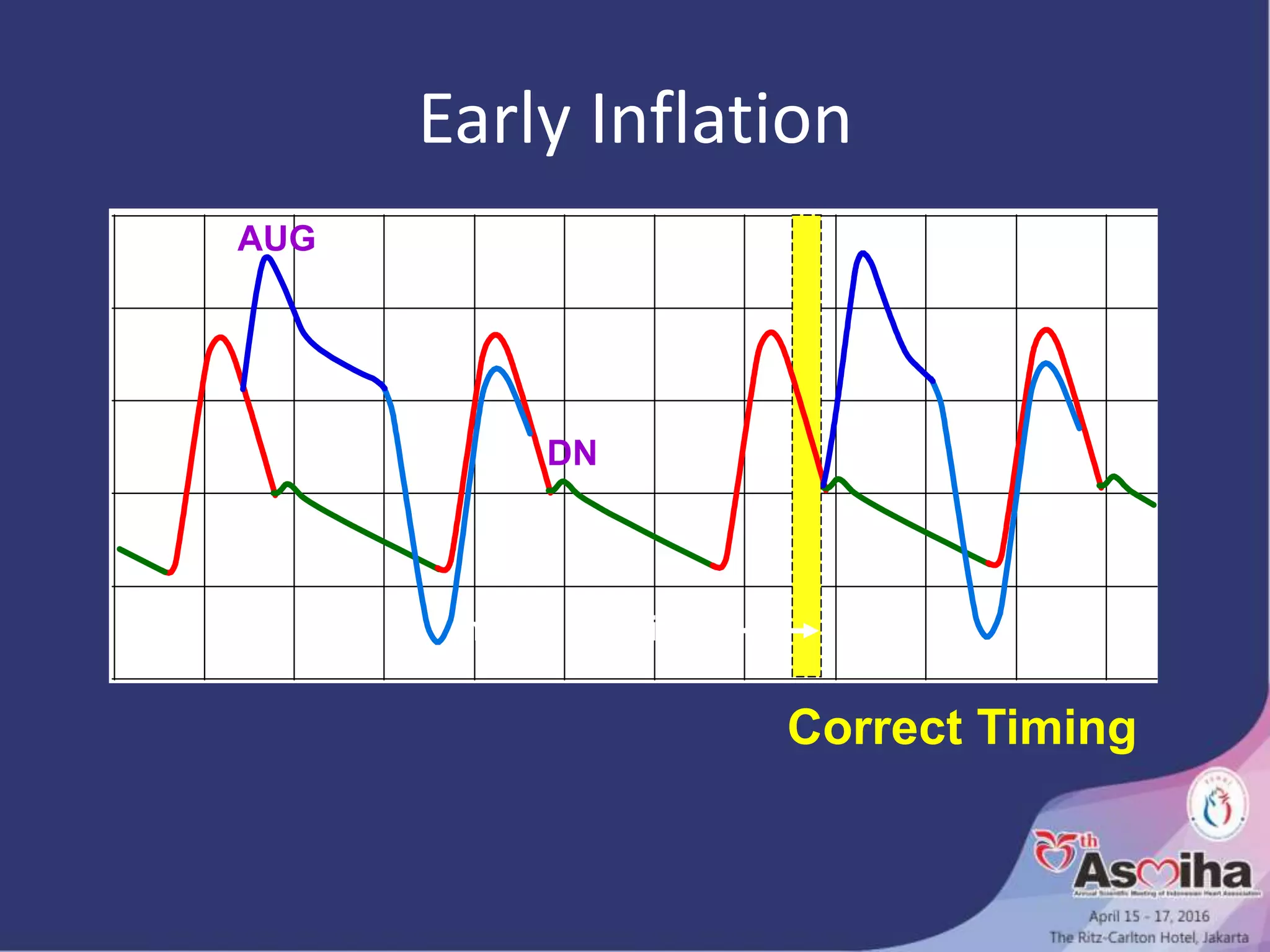 Early Inflation
Correct Timing
AUG
DN
move inflation
 
