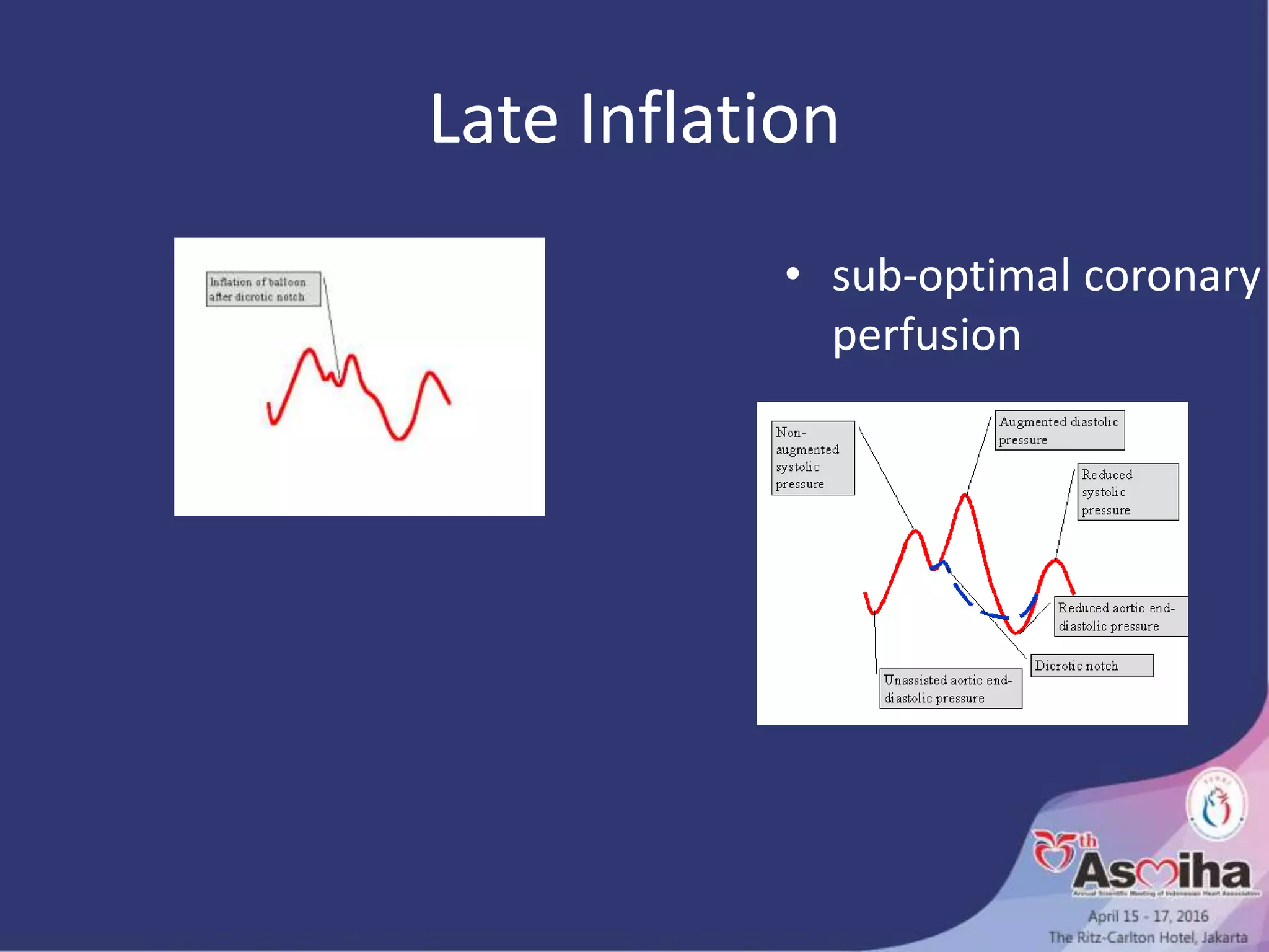 Late Inflation
• sub-optimal coronary
perfusion
 