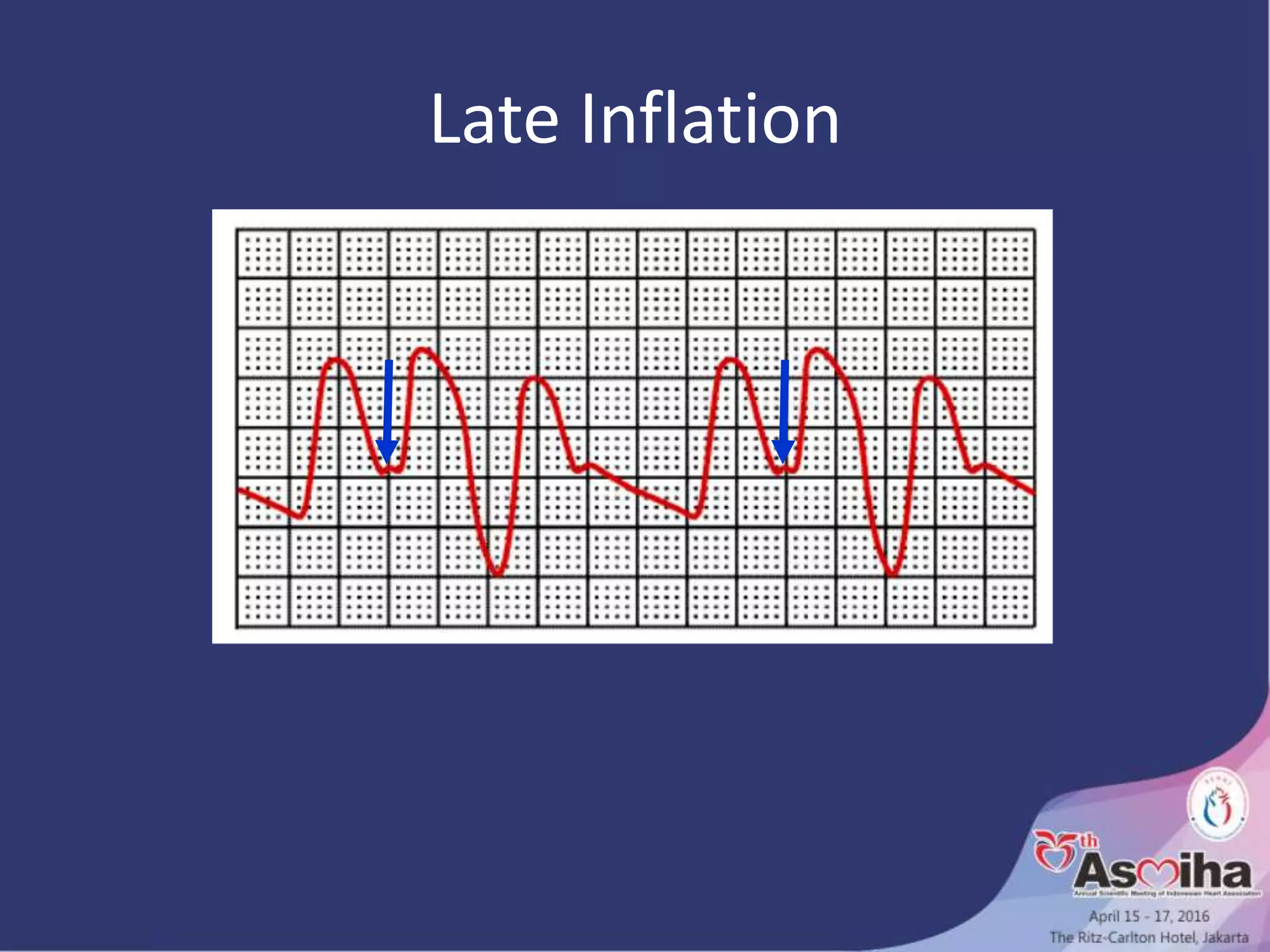 Late Inflation
 