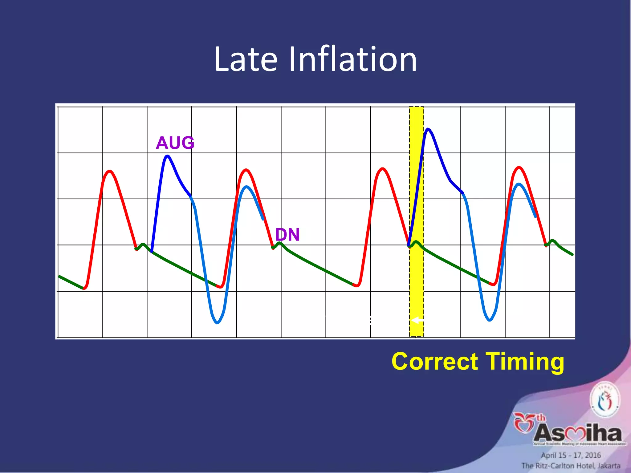 Late Inflation
Correct Timing
AUG
DN
move inflation
 