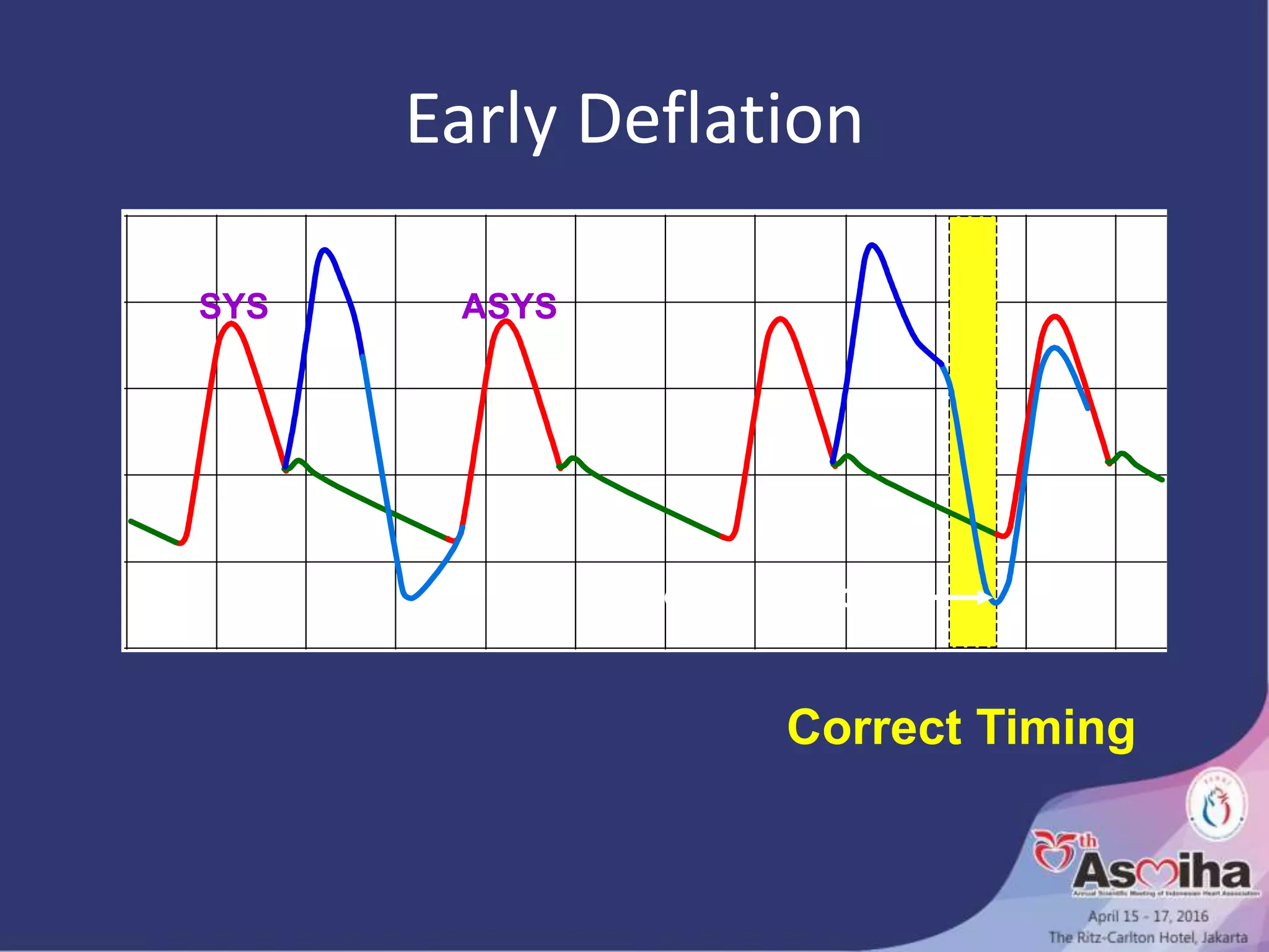 move deflation
SYS ASYS
Early Deflation
Correct Timing
 