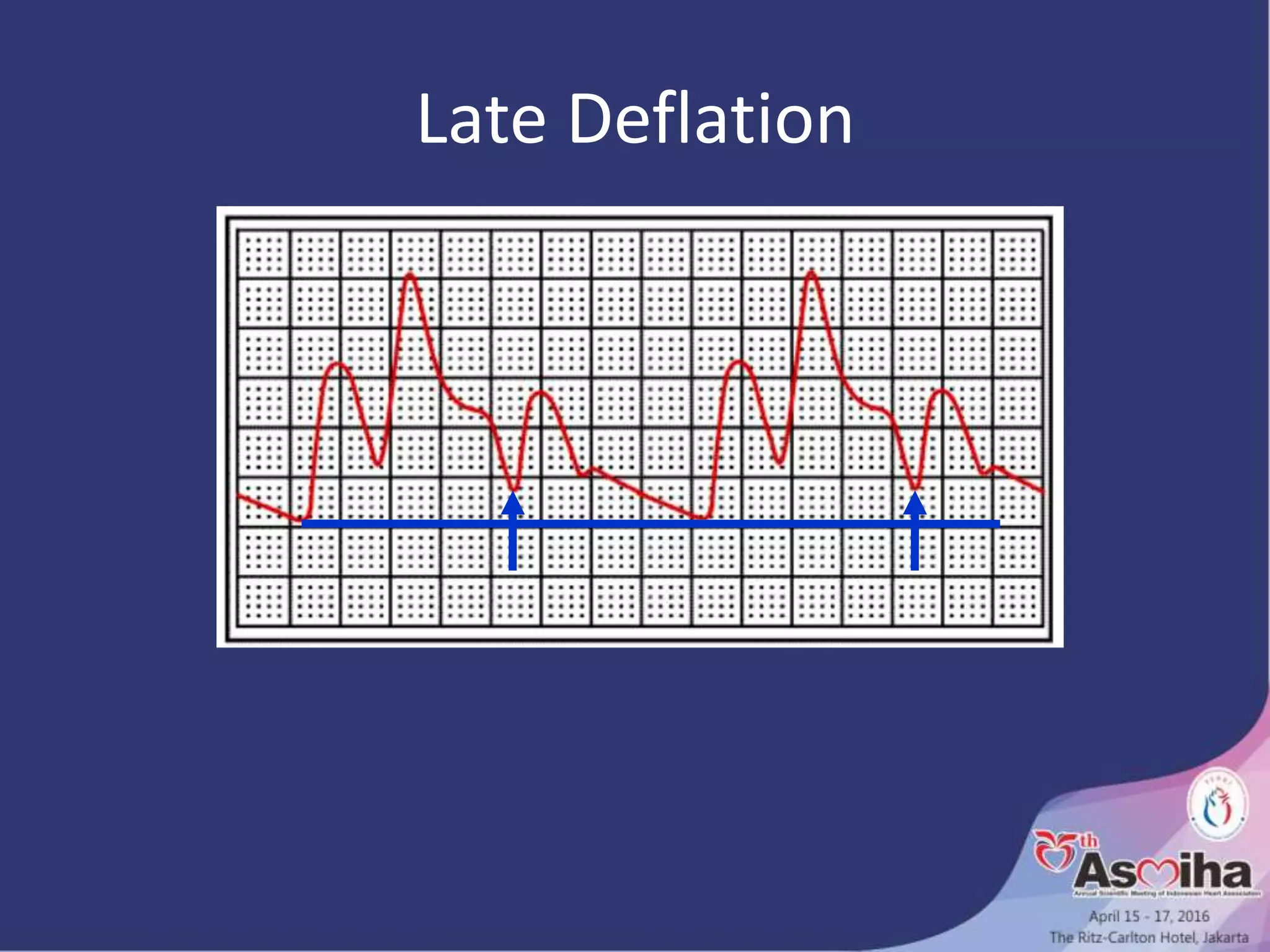 Late Deflation
 