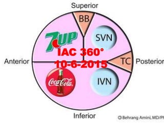 IAC 360°
15-12-2015
12.43pm
 