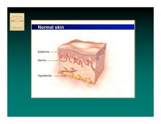 Normal skin




Epidermis


Dermis




Hypodermis
 