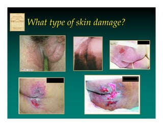 What type of skin damage?
 
