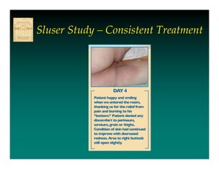 Sluser Study – Consistent Treatment
 