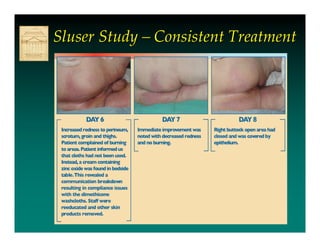 Sluser Study – Consistent Treatment
 