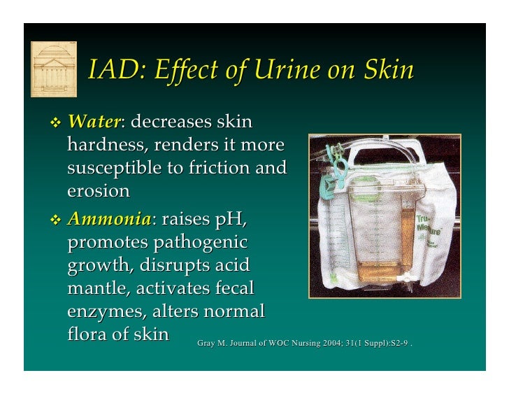 Incontinence Associated Dermatitis by Prof Dr Mikel Gray