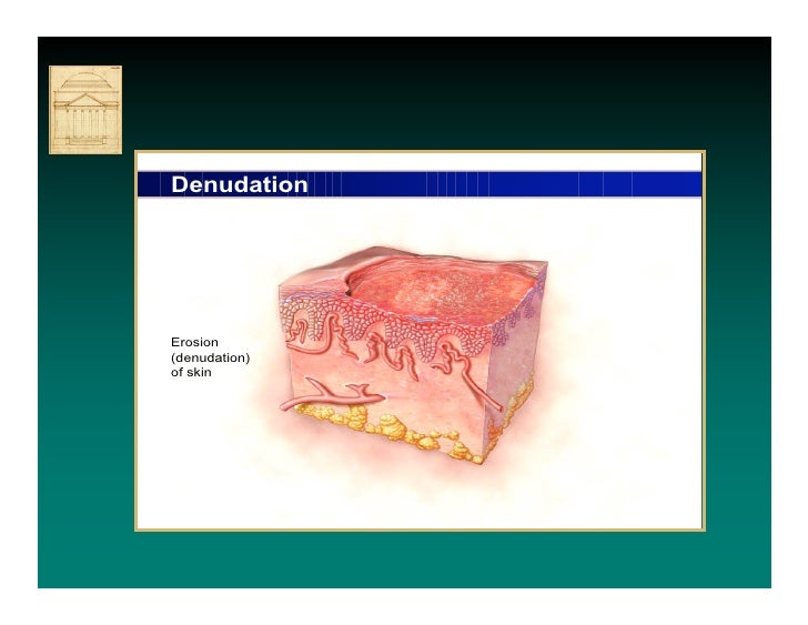 Denuded wound Nude Photos 44 Denuded wound Nude Photos 98