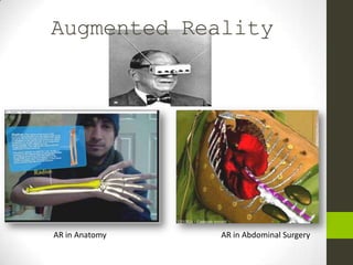 Augmented Reality




AR in Anatomy   AR in Abdominal Surgery
 