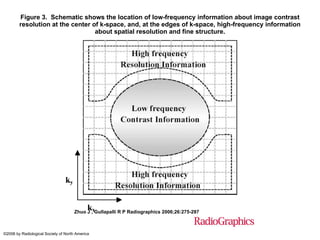 Figure 3.  Schematic shows the location of low-frequency information about image contrast resolution at the center of k-space, and, at the edges of k-space, high-frequency information about spatial resolution and fine structure. Zhuo J , Gullapalli R P Radiographics 2006;26:275-297 ©2006 by Radiological Society of North America 