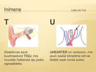 Inimene						Lotte Liis TüviTSisekõrvas asub kuulmiselund TIGU, mis muudab helilained aju jaoks signaalideks.UUNEARTERon veresoon, mis asub kaelal kõrisõlme kõrval. Sellelt saab tunda pulssi.
