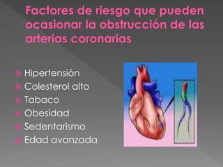  Hipertensión
 Colesterol alto
 Tabaco
 Obesidad
 Sedentarismo
 Edad avanzada
 