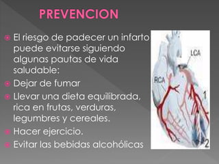  El riesgo de padecer un infarto
puede evitarse siguiendo
algunas pautas de vida
saludable:
 Dejar de fumar
 Llevar una dieta equilibrada,
rica en frutas, verduras,
legumbres y cereales.
 Hacer ejercicio.
 Evitar las bebidas alcohólicas
 