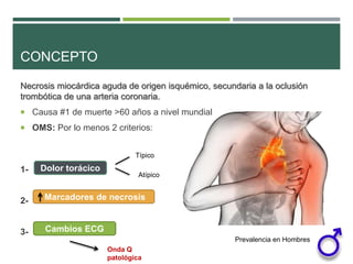 CONCEPTO
Necrosis miocárdica aguda de origen isquémico, secundaria a la oclusión
trombótica de una arteria coronaria.
 Ca...