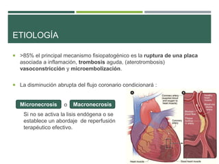ETIOLOGÍA
 >85% el principal mecanismo fisiopatogénico es la ruptura de una placa
asociada a inflamación, trombosis aguda...