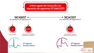 infarto agudo al miocardio con elevacion del st | PDF
