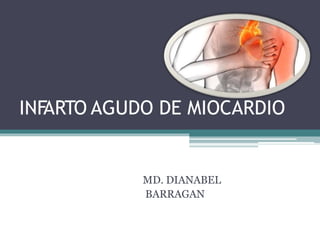 INF
ARTO AGUDO DE MIOCARDIO
MD. DIANABEL
BARRAGAN
 