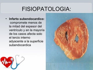 FISIOPATOLOGIA:
• Infarto subendocardico:
compromete menos de
la mitad del espesor del
ventrículo y en la mayoría
de los casos afecta solo
el tercio interno
adyacente a la superficie
subendocardica
 