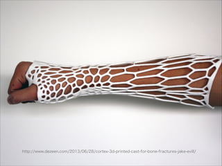 http://www.dezeen.com/2013/06/28/cortex-3d-printed-cast-for-bone-fractures-jake-evill/

 