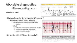 Abordaje diagnostico
-Electrocardiograma-
• Ondas T altas
• Nueva elevación del segmento ST (punto J)
• Al menos 2 derivaciones contiguas
• Todas las derivaciones (excepto V2 y V3)
• ≥ 1 mm
• V2-v3
• ≥ 2,5 mm en los varones menores de 40 años
• ≥ 2 mm en los varones de 40 o más
• ≥ 1,5 mm en las mujeres
• Depresion del ST / inversion onda T
 