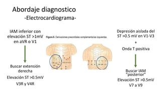 Abordaje diagnostico
-Electrocardiograma-
Depresión aislada del
ST >0.5 mV en V1-V3
+
Onda T positiva
Buscar IAM
“posterior”
Elevación ST >0.5mV
V7 a V9
IAM inferior con
elevación ST >1mV
en aVR o V1
Buscar extensión
derecha
Elevación ST >0.5mV
V3R y V4R
 