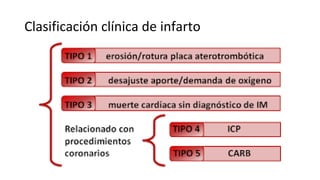 Clasificación clínica de infarto
 