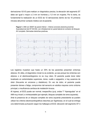 Infarto agudo al Miocardio con elevación del segmento ST y Terapias de ...