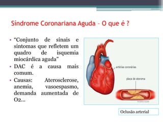 Síndrome Coronariana Aguda – O que é ? 
• “Conjunto de sinais e 
sintomas que refletem um 
quadro de isquemia 
miocárdica aguda” 
• DAC é a causa mais 
comum. 
• Causas: Aterosclerose, 
anemia, vasoespasmo, 
demanda aumentada de 
O2... 
Oclusão arterial 
 