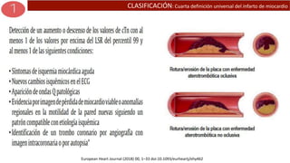CLASIFICACIÓN: Cuarta definición universal del infarto de miocardio
European Heart Journal (2018) 00, 1–33 doi:10.1093/eurheartj/ehy462
 