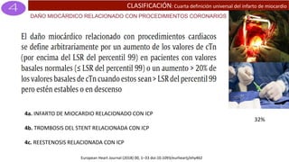 CLASIFICACIÓN: Cuarta definición universal del infarto de miocardio
DAÑO MIOCÁRDICO RELACIONADO CON PROCEDIMIENTOS CORONARIOS
32%
4a. INFARTO DE MIOCARDIO RELACIONADO CON ICP
4b. TROMBOSIS DEL STENT RELACIONADA CON ICP
4c. REESTENOSIS RELACIONADA CON ICP
European Heart Journal (2018) 00, 1–33 doi:10.1093/eurheartj/ehy462
 