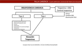 FALLA CARDÍACA : Cuarta definición universal del infarto de miocardio
• Aumento presión transmural
• Obstrucción pequeños vasos
• Anemia
• Hipotensión
• Estiramiento de la pared (autofagia)
• Inflamación
• Exocitosis de la troponina
INSUFICIENCIA CARDIACA
Tipo 2 Tipo I
European Heart Journal (2018) 00, 1–33 doi:10.1093/eurheartj/ehy462
Elevación
Troponinas
Troponina + EKG
Control troponina
Clínica
Cambios EKG
Disminución FEVI
 