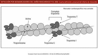 DETECCIÓN POR BIOMARCADORES DEL DAÑO MIOCARDICO Y EL IAM: Cuarta definición universal del infarto de miocardio
European Heart Journal (2018) 00, 1–33 doi:10.1093/eurheartj/ehy462
Marcador cardioespecífico mas sensible
 