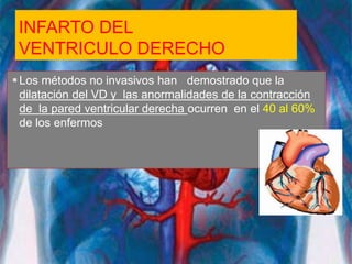 INFARTO DEL
VENTRICULO DERECHO
Los métodos no invasivos han demostrado que la
dilatación del VD y las anormalidades de la contracción
de la pared ventricular derecha ocurren en el 40 al 60%
de los enfermos
 